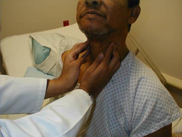 Λεμφαδενίτιδα στο λαιμό: αιτίες, συμπτώματα και θεραπείες